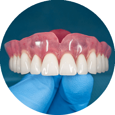 traditional supported denture model