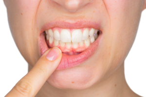 Woman checking her gums