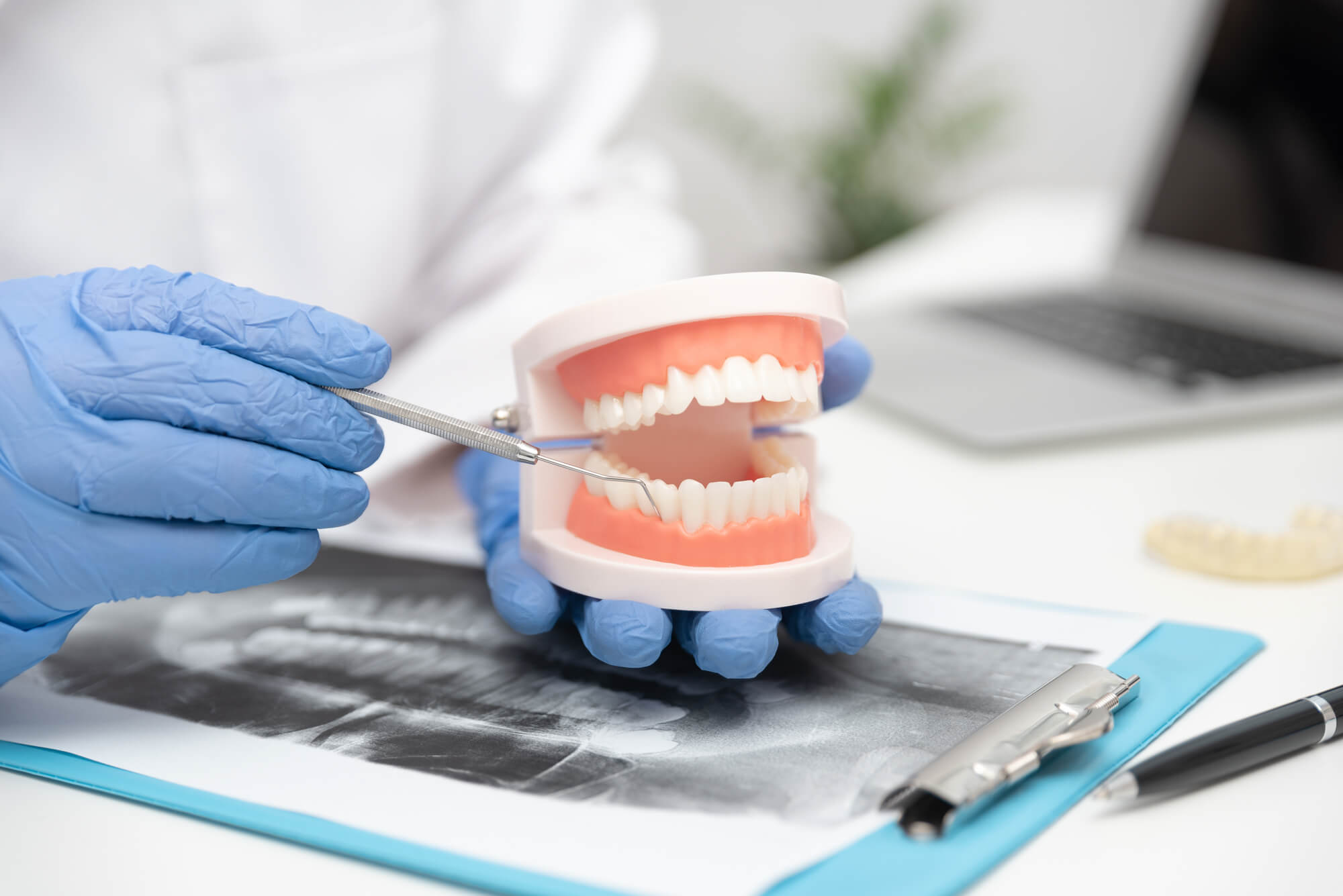 Doctor pointing to dental example model