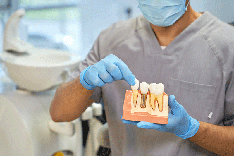 A dental doctor with a model of a dental implant in his hands.